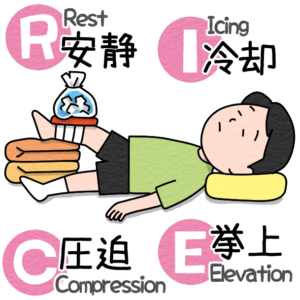 ケガの応急処置RICE処置の方法を示すイラスト